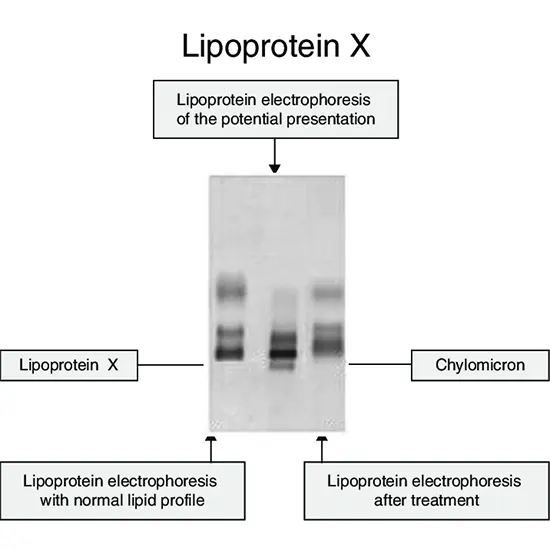lipoprotein electrophoresis test